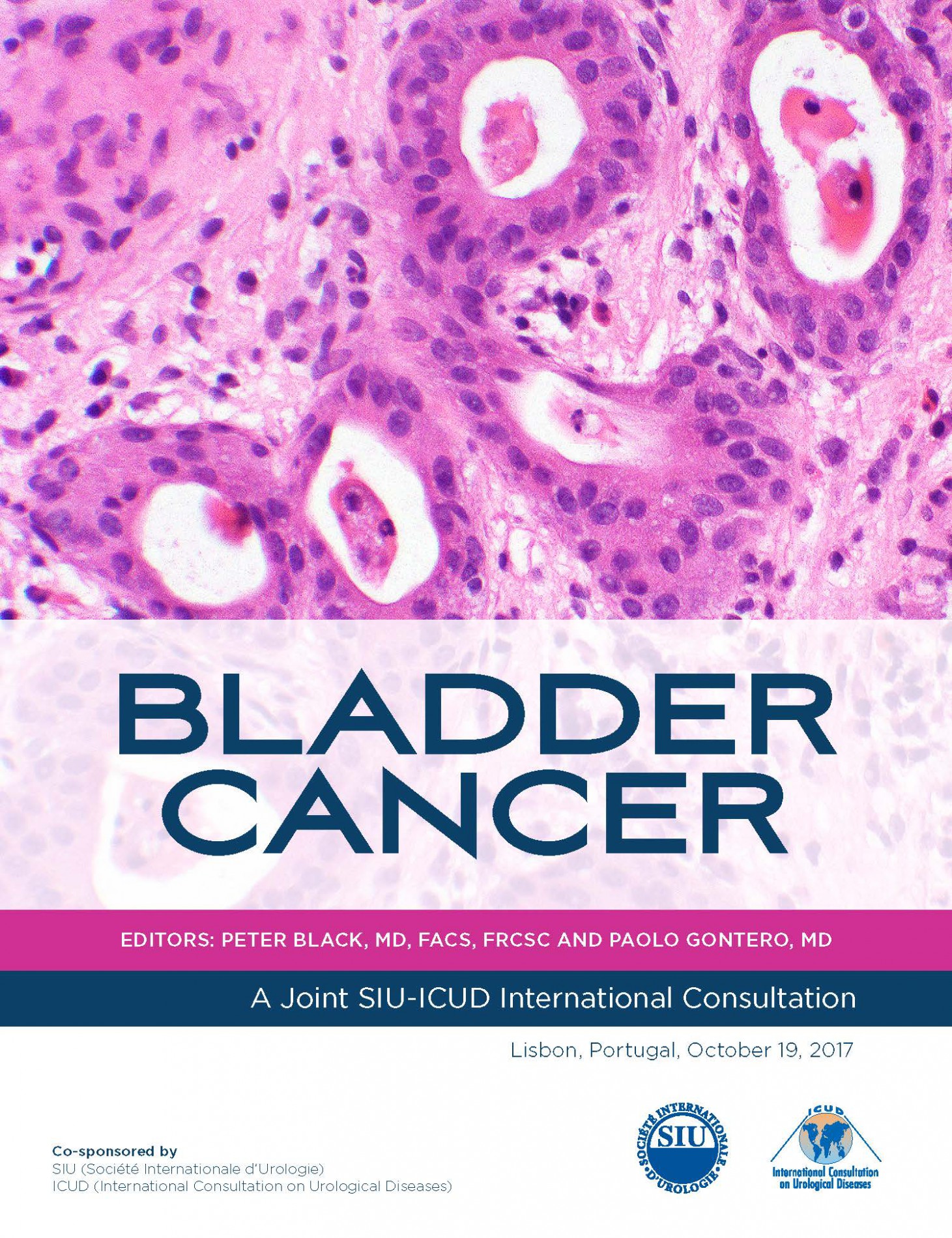 Bladder Cancer (2017)